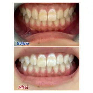 MBEAUTYSALON 千葉店・京成大久保所属・Melty 輝のその他イメージ