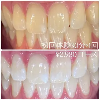 PLATINUM Beauty 横浜店所属・ホワイトニングルーム 横浜店のその他イメージ