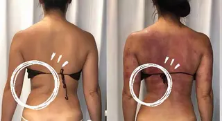 美容整体・塗る漢方・フェイシャルRechica所属・心斎橋痩身 美肌整体サロン💓のエステ・リラクイメージ