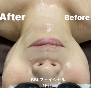 メンズ Epina 千葉店 【エピナ】のエステ・リラクイメージ