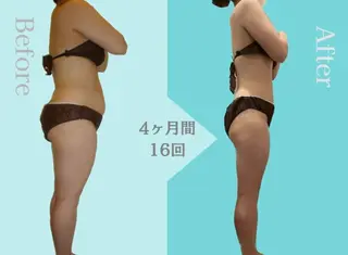 サロンハート浦和店所属・痩身小顔サロンハート 浦和店のエステ・リラクイメージ