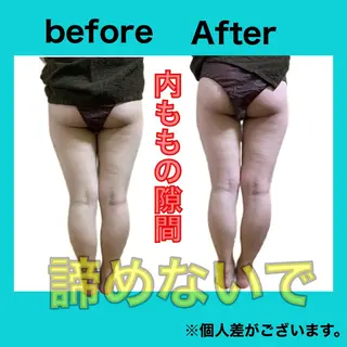 痩身/脱毛/ネイル HARUKAのエステ・リラクイメージ