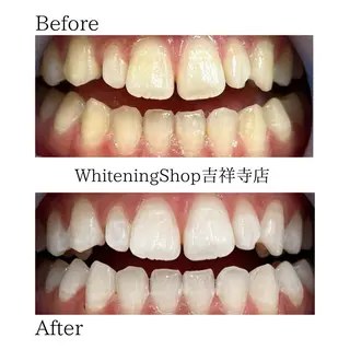 ホワイトニングショッ 吉祥寺2号店のエステ・リラクイメージ