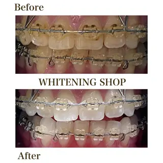 ホワイトニングショップ静岡葵区店所属・ホワイトニング ショップ葵区静岡駅店のその他イメージ