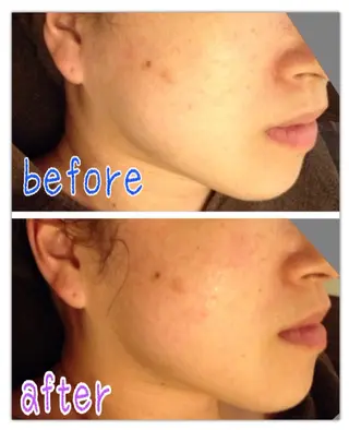 ティータイム所属・おうちエステサロン Teatimeのエステ・リラクイメージ