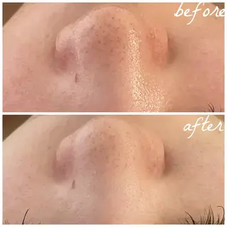 メンズ メナード岐阜茜部 杉浦のエステ・リラクイメージ