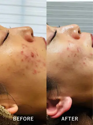 LukeBeauty salonのエステ・リラクイメージ