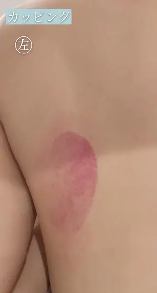 🅖🅤🅩🅔🅛 salonのエステ・リラクイメージ