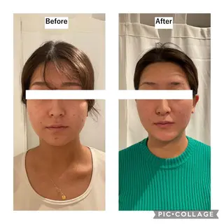 12Dハイフ💗 最強小顔のエステ・リラクイメージ