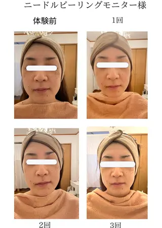 MA CHÉRIE所属・体質別痩身&小顔 MA CHÉRIEのエステ・リラクイメージ