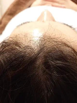 北梅田美容鍼灸院所属・美容鍼マイスター 川村　淳のエステ・リラクイメージ