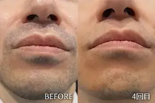 private salon meのエステ・リラクイメージ