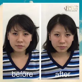 小顔&ダイエットジム エステ担当REIKOのその他イメージ