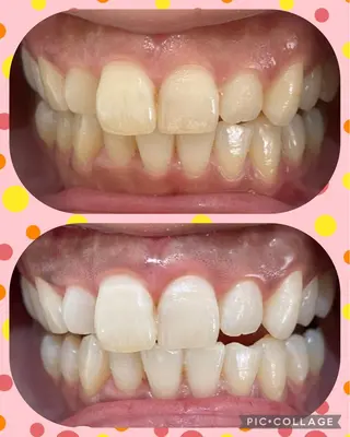 DIA WHITE 奥田のその他イメージ