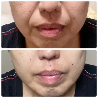 POLA 北花田店のエステ・リラクイメージ