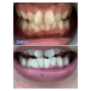 MBEAUTYSALON 千葉店・京成大久保所属・Melty 輝のその他イメージ