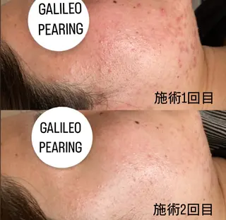 eclair エクレイルのエステ・リラクイメージ