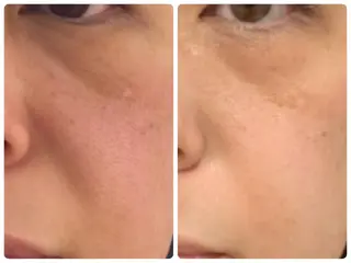 トータル美容 RAYVIS札幌店のエステ・リラクイメージ