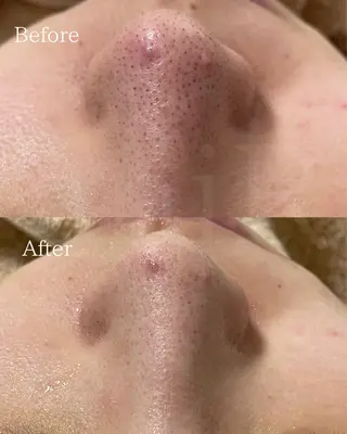 北浜/毛穴洗浄ツヤ肌 サロンaniRのエステ・リラクイメージ