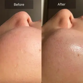 Mandarin Orange所属・毛穴から始める肌メン テマンダリンオレンジのエステ・リラクイメージ