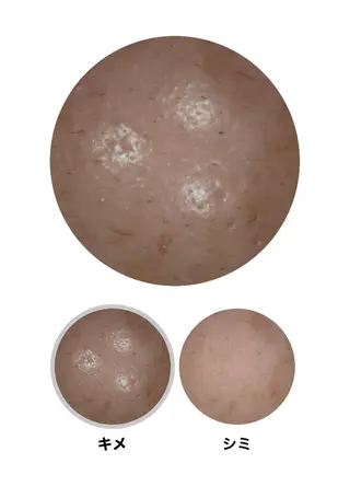 メナードフェイシャルサロン天王寺駅東口代行店所属・メナード天王寺駅東口 稲冨恵美のエステ・リラクイメージ