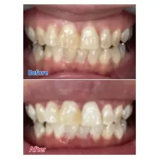 M渋谷店所属・M渋谷 ホワイトニングのエステ・リラクイメージ