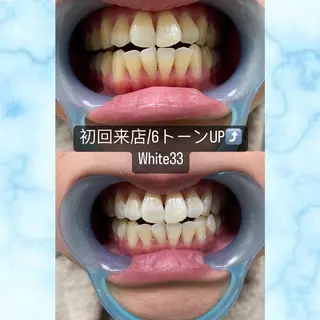 セルフホワイトニング　アデル所属・戸嶋 菫のエステ・リラクイメージ