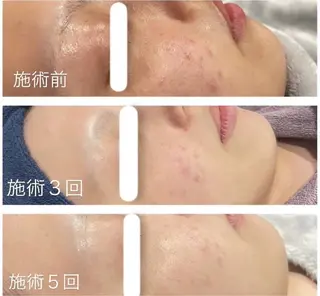 アンド ミルルのエステ・リラクイメージ