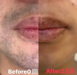 メンズ パーソナルカウンセラー付き:メンズセルフ脱毛・セルフホワイトニング専門店 ズボコスサロン笹塚所属・パーソナルセルフ脱毛 ズボコスサロンのエステ・リラクイメージ