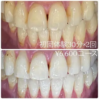 メンズ ホワイトニングルーム　川崎店所属・ホワイトニング ルーム　川崎店のその他イメージ