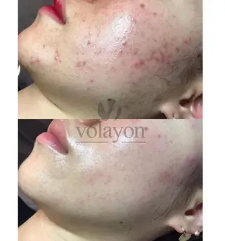 crescent所属・【韓国肌管理・脱毛】 クレセントのエステ・リラクイメージ