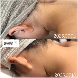 キッズ 子供脱毛専門サロンReme【リミー】所属・添田 彩葉のエステ・リラクイメージ