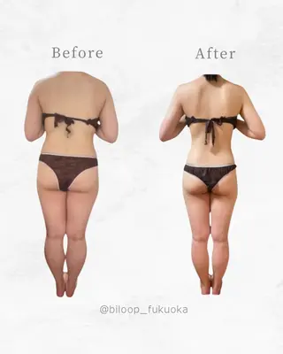 biloop所属・《本気痩せ×疲労改善 》  BILOOPのエステ・リラクイメージ