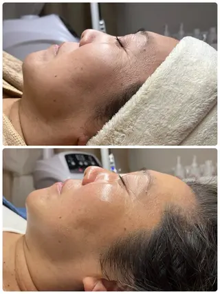 SILOE【ハーブピーリング/REVI/ニキビ/シミ/シワ/毛穴ケア】所属・【SILOE】 ハーブピーリングのエステ・リラクイメージ