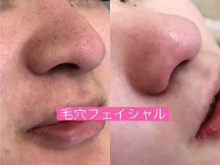 毛穴洗浄& 睫毛パーマ上野御徒町のマツエク・マツパデザイン