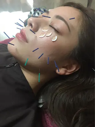 美容鍼灸女性専用 りんご鍼灸治療院のエステ・リラクイメージ