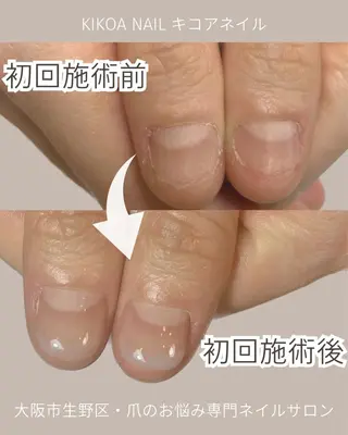 ネイル KIKOA NAIL キコアネイルのネイルデザイン