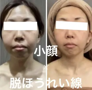 🌷U24毛穴エステ レイビスMURA🌷のエステ・リラクイメージ