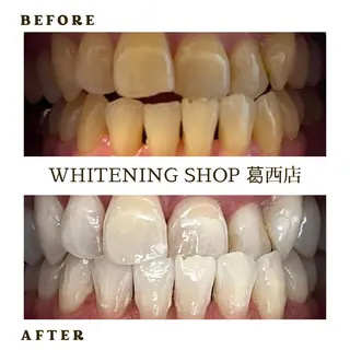 メンズ ホワイトニング ショップ葛西店のその他イメージ