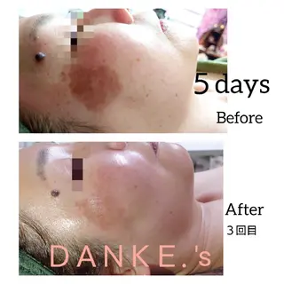 ＤＡＮＫＥ. サポートナースゆうこのエステ・リラクイメージ