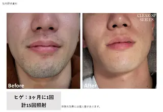 VIERU YURIのネイルデザイン