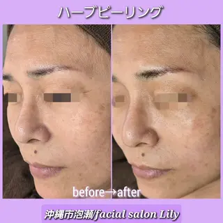 facial salon Lily所属・salon Lilyのエステ・リラクイメージ