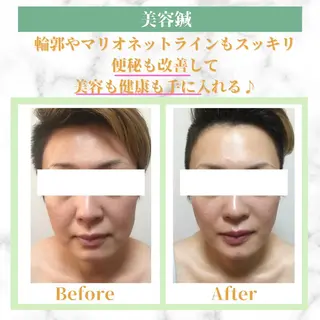 美容鍼灸師 齋藤 麗子のエステ・リラクイメージ