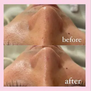 韓国肌管理専門店 White labo 宝塚店所属・有川 凜のエステ・リラクイメージ