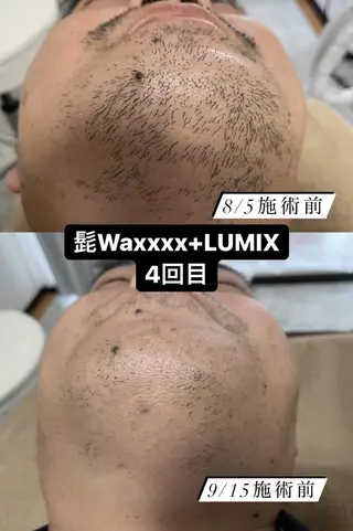 メンズ キッズ Epina 千葉店 【エピナ】のエステ・リラクイメージ