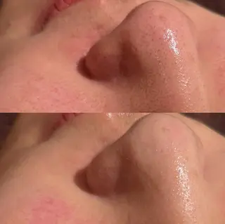 for woman所属・森 美優のエステ・リラクイメージ