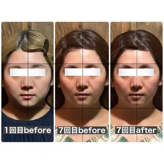 💎後悔させない小顔 矯正💎イトヤマ🌱のエステ・リラクイメージ