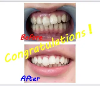 セルフホワイトニングサロン　ラヴィアン所属・ホワイトニングサロン La vie enのその他イメージ