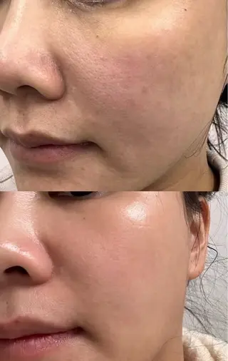 パーマ aliaハイフ&水光ジェットサロン所属・aliaハーブ水光店 エステティシャン募集のエステ・リラクイメージ