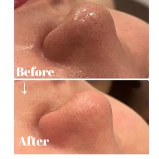 よもぎ蒸しエステサロン★yun所属・よもぎ蒸しサロン ゆんのエステ・リラクイメージ